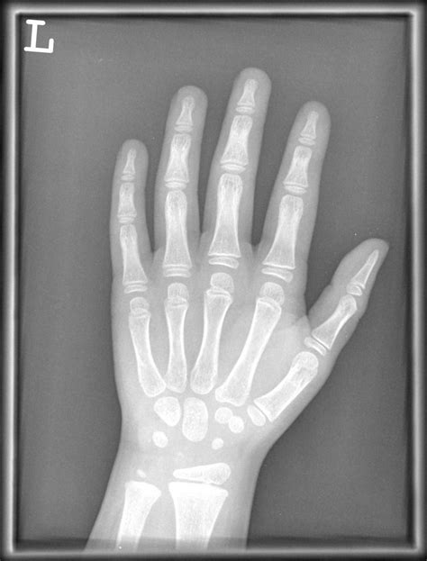 Image result for How to Sweep From 0 to 90 Degrees in Python Code