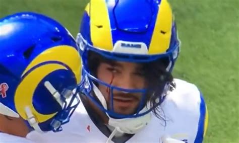 NFL star Puka Nacua bleeds from the EYE before concussion check in scary scenes