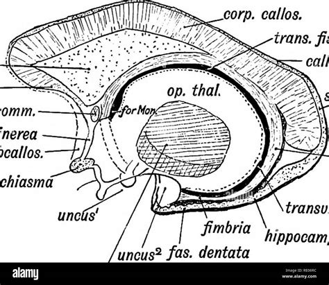 Image result for Lamina Terminalis Embryonic Development