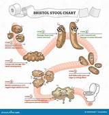 Bristol Stool Chart with Excrement Description and Types Outline ...