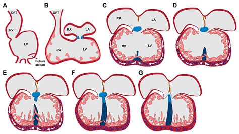 Interventricular Septum Development