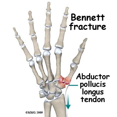 forearm and wrist Flashcards | Quizlet