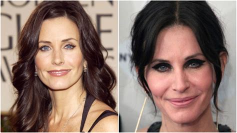 Courteney Cox Surgery
