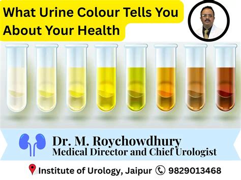 Double J Stent: What Is It and What to Expect After Placement