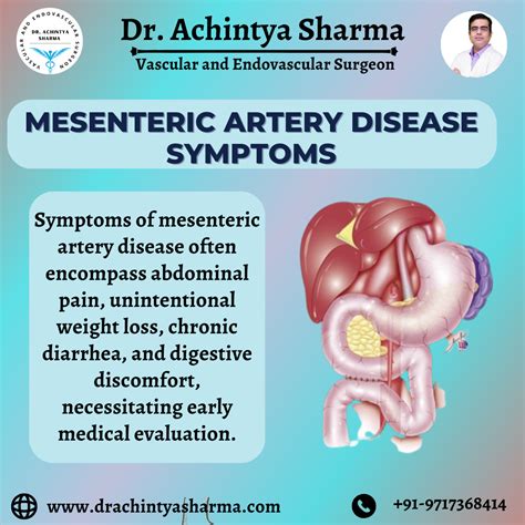 Causes Of Mesenteric Edema