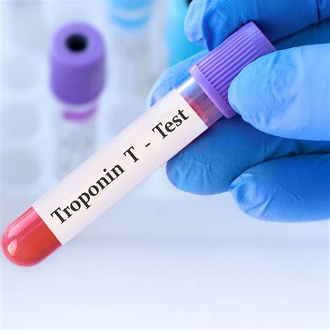 Troponin – ein rein kardialer Biomarker? - Kardiologie & Gefäßmedizin ...