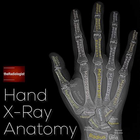 Read on to find out more about my review areas on a hand X-Ray ...