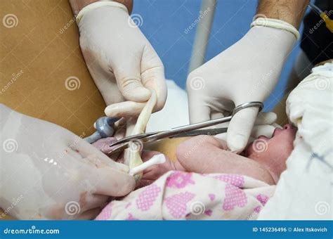 Cutting the Umbilical Cord between a Newborn Baby and Placenta Stock ...