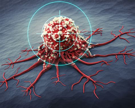 Ultrasound-Guided Breast Biopsy – GIC Prime