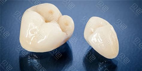 全瓷牙冠 - 韩国牙齿整形