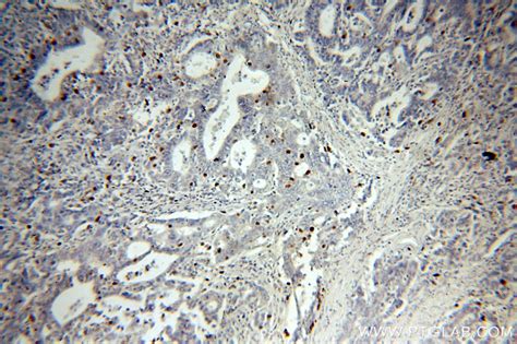 PD-L1/CD274 antibody (17952-1-AP) | Proteintech