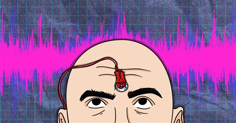 Image result for Single Fiber EMG Test