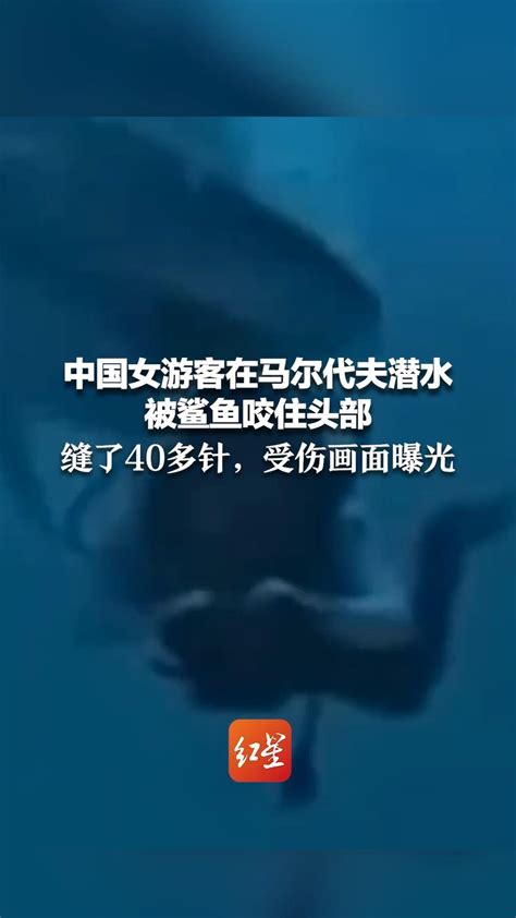 女子潜水被鲨鱼咬伤后遭网暴最新素材