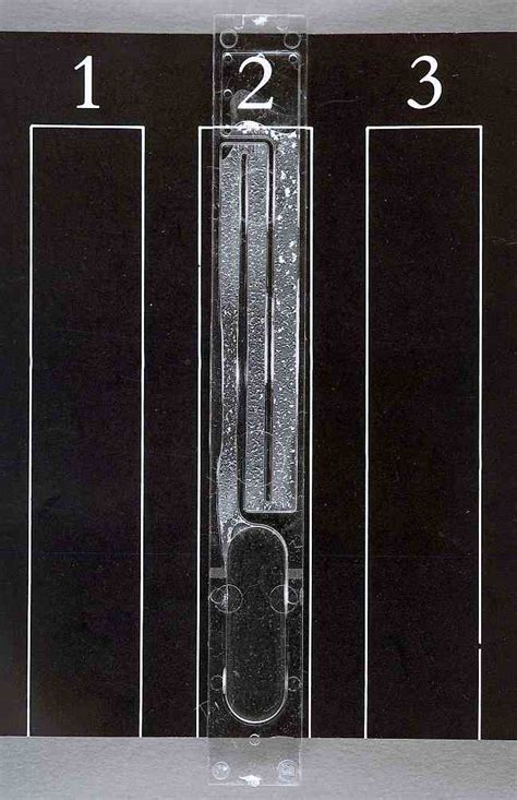 Diagnosis HIV - Alomedika