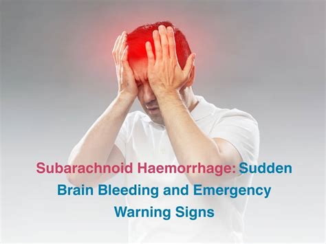 Subarachnoid Haemorrhage: Sudden Brain Bleeding and Emergency Warning Signs