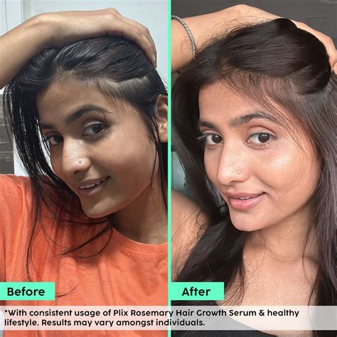 The Plant Fix Plix Rosemary Advanced Hair Growth Serum with 3% Redensyl ...