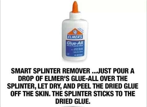 Image result for Remove Splinter