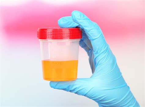 Test Blood In Urine At Home at Dianne Fournier blog