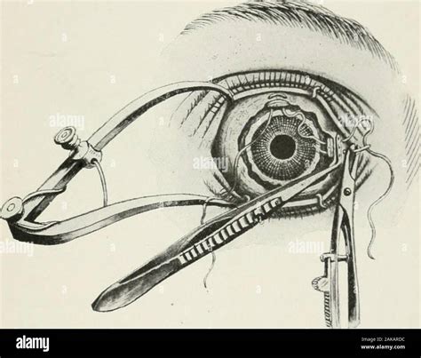 The American encyclopedia and dictionary of ophthalmology Edited by Casey AWood, assisted by a ...