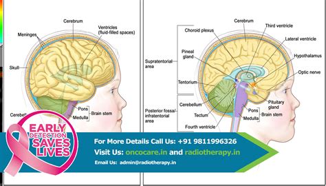 Doctor for Cancer in Delhi, India, Radiation Treatment for Cancer in India.