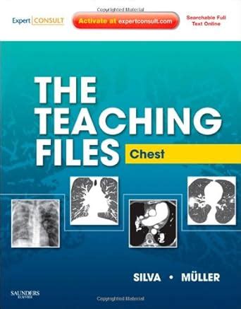 Buy The Teaching Files: Chest: Expert Consult - Online and Print ...