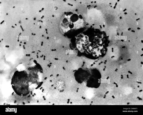 Deadly plague Black and White Stock Photos & Images - Alamy