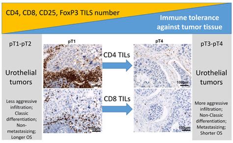 Changes in Immunogenicity during the Development of Urinary Bladder ...