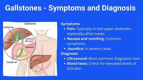 Gallstone and Kidney Stone - Know The Difference.pptx