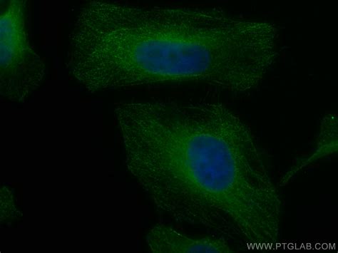 AMPK Beta 2 antibody (CL488-66579) | Proteintech