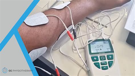 Complete Guide to Electrical Stimulation for Stroke Recovery