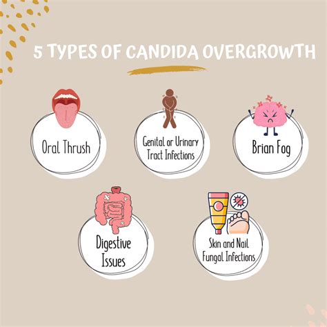 5 Different Types of Candida Overgrowth - Beauty of Inside Out