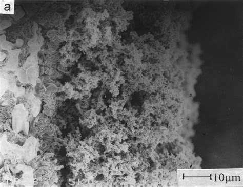 Surfactant therapy for respiratory distress syndromes