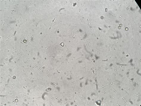 Types of Bacteria in Urine