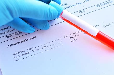 Image result for Prothrombin Time Normal Result