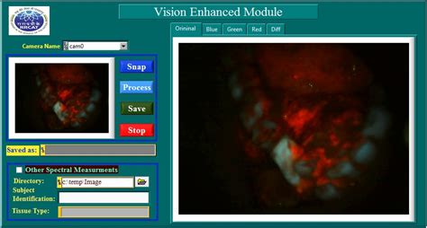 Vision Enhancement Module (VEM) – Bhabha Atomic Research Centre ( BARC )
