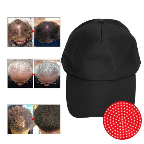 Buy Hair Regrowth Helmet, Hair Growth Helmet with 140 Lasers, Effective ...
