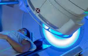 Curative-intent radiotherapy with IMPT for Oropharyngeal Carcinoma ...