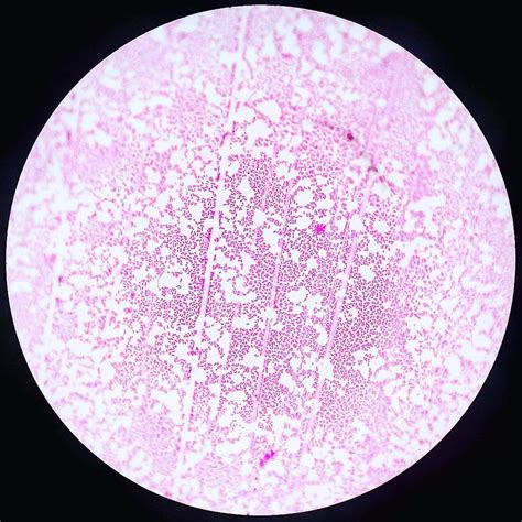 Haemophilus influenzae not type b - Gram Stain