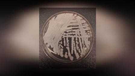 中国18例超级真菌感染是怎么回事？耳念珠菌在世界各地医院繁殖-闽南网
