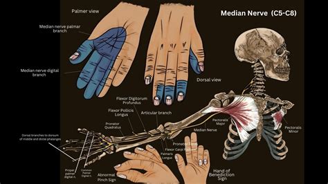Median Nerve Injury