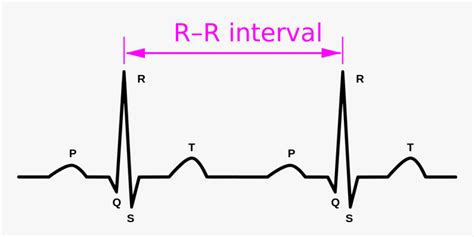 Image result for R-R Interval Calculation for ECG Code in Python