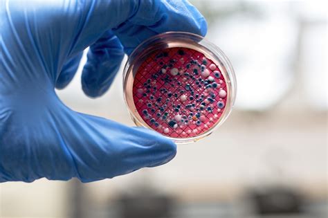 Escherichia Coli Pronunciation