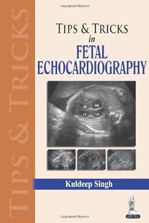 Buy Tips and Tricks in Fetal Echocardiography Book Online at Low Prices ...