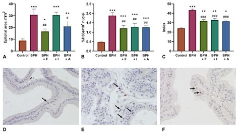 Astaxantin and Isoflavones Inhibit Benign Prostatic Hyperplasia in Rats ...