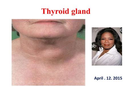 Image result for Thyroid Function Algorithm