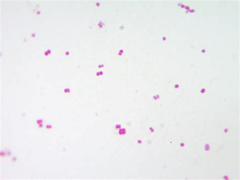 Gram negative diplococci; coffee bean shape; oxidase positive, catalase ...