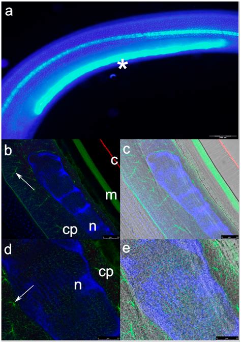 Functional Ultrastructure of the Excretory Gland Cell in Zoonotic ...