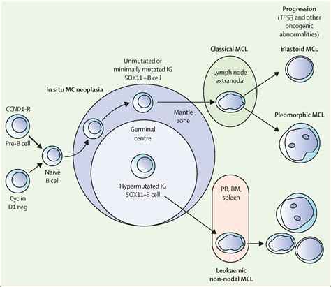 B-cell non-Hodgkin lymphomas - The Lancet