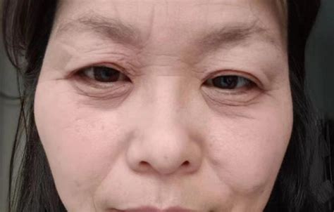 42岁女子20天内“断崖式衰老” 比65岁的母亲还显老-社会新闻_华商网新闻