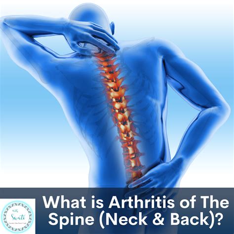 Arthritis In Back Muscle Pain at Anna Octoman blog